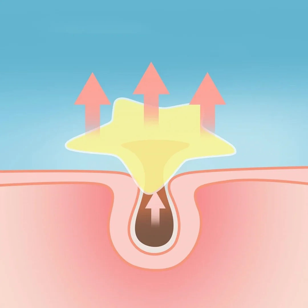 Star and Heart Acne Patch